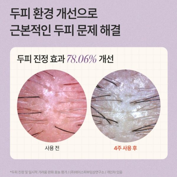 트리코닉스 트리코엑스 탈모완화 볼륨 샴푸, 1개, 500ml 이미지 5